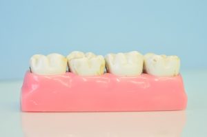 Interconnected Health & the Removal of Wisdom Teeth
